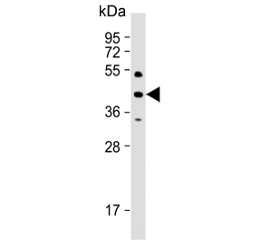 Western blot testing of human 293T/17 cell lysate with PHKG2 antibody. Predicted molecular weight ~44 kDa.