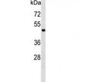 Western blot testing of human HepG2 cell lysate with PHKG2 antibody. Predicted molecular weight ~44 kDa.