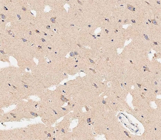 IHC testing of FFPE human brain tissue with Prohibitin 2 antibody. HIER: steam section in pH9 EDTA buffer for 20 min and allow to cool prior to staining.
