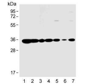 Western blot testing of 1) human Raji, 2) human HEK293, 3) human HeLa, 4) human MDA-MB-453, 5) mouse NIH 3T3, 6) mouse brain and 7) rat C6 cell lysate with Prohibitin 2 antibody. Predicted molecular weight ~33 kDa.