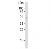 Western blot testing of human blood plasma lysate with Pigment epithelium-derived factor antibody. Predicted molecular weight ~46 kDa.