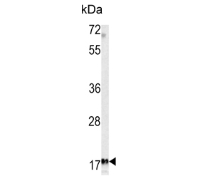 Western blot testing of human K562 cell lysate with Microfibrillar-associated protein 5 antibody. Predicted molecular weight: 19-25 kDa depending on glycosylation level.