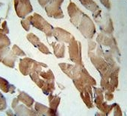 IHC testing of FFPE human skeletal muscle tissue with GSN antibody. HIER: steam section in pH6 citrate buffer for 20 min and allow to cool prior to staining.
