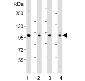 Western blot testing of 1) human plasma, 2) human HeLa, 3) mouse spleen and 4) rat kidney lysate with GSN antibody. Predicted molecular weight: 81-86 kDa (multiple isoforms).