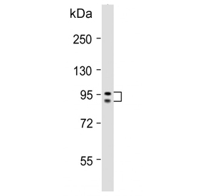 Western blot testing of human MCF7 cell lysate with GSN antibody. Predicted molecular weight: 81-86 kDa (multiple isoforms).