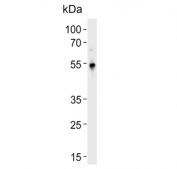 Western blot testing of human CCRF-CEM cell lysate with Krueppel-like factor 5 antibody. Predicted molecular weight: 34-51 kDa (multiple isoforms).