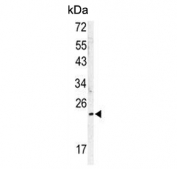 Western blot testing of human A2058 cell lysate with MOB kinase activator 1A antibody. Predicted molecular weight ~25 kDa.