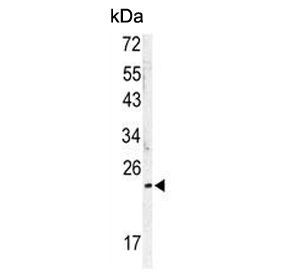 Western blot testing of human A2058 cell lysate with MOB kinase activator 1A antibody. Predicted molecular weight ~25 kDa.