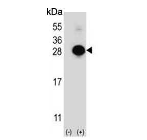 Western blot testing of 1) non-transfected and 2) transfected 293 cell lysate with MOB kinase activator 1A antibody.