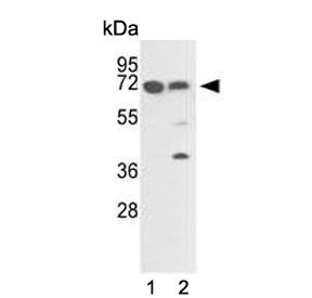 Western blot testing of human 1) A2058 and 2) A375 cell lysate with FKBP10 antibody. Predicted molecular weight ~64 kDa.