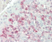 IHC testing of FFPE human tonsil tissue with FKBP10 antibody. HIER: steam section in pH6 citrate buffer for 20 min and allow to cool prior to staining.
