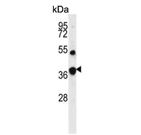 Western blot testing of human MCF7 cell lysate with Fructose-1,6-bisphosphatase 1 antibody. Predicted molecular weight ~37 kDa.