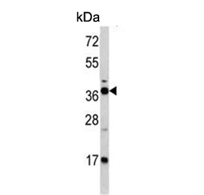 Western blot testing of mouse kidney tissue lysate with Fructose-1,6-bisphosphatase 1 antibody. Predicted molecular weight ~37 kDa.