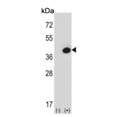 Western blot testing of 1) non-transfected and 2) transfected 293 cell lysate with Fructose-1,6-bisphosphatase 1 antibody.