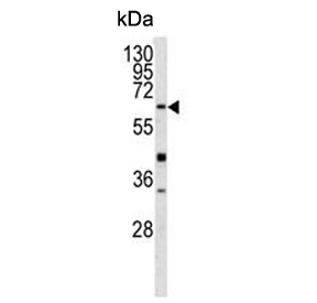 Western blot testing of mouse heart tissue lysate with Glutathione hydrolase 5 proenzyme antibody. Predicted molecular weight ~62 kDa.