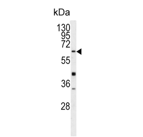 Western blot testing of human Y79 cell lysate with Glutathione hydrolase 5 proenzyme antibody. Predicted molecular weight ~62 kDa.