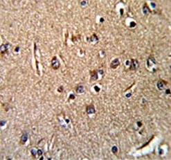 IHC testing of FFPE human brain tissue with Glutathione hydrolase 5 proenzyme antibody. HIER: steam section in pH6 citrate buffer for 20 min and allow to cool prior to staining.