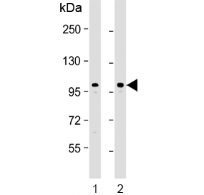 Western blot testing of human 1) U-2 OS and 2) HUVEC lysate with GIT1 antibody. Expected molecular weight: 84-95 kDa.
