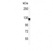 Western blot testing of mouse lung tissue lysate with VCL antibody. Predicted molecular weight ~124 kDa.