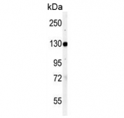 Western blot testing of human K562 cell lysate with VCL antibody. Predicted molecular weight ~124 kDa.