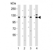 Western blot testing of 1) human RD, 2) human HeLa, 3) rat liver and 4) human testis lysate with VCL antibody. Predicted molecular weight ~124 kDa.