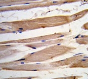 IHC testing of FFPE human skeletal muscle tissue with VCL antibody. HIER: steam section in pH6 citrate buffer for 20 min and allow to cool prior to staining.
