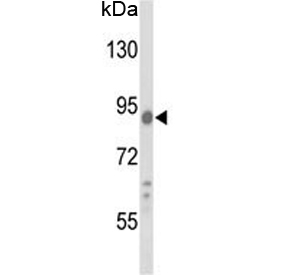 Western blot testing of human A2058 cell lysate with COG4 antibody. Predicted molecular weight ~89 kDa.