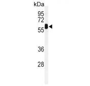 Western blot testing of mouse lung tissue lysate with EH domain-containing protein 3 antibody. Predicted molecular weight ~61 kDa.