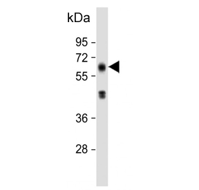 Western blot testing of human brain tissue lysate with EH domain-containing protein 3 antibody. Predicted molecular weight ~61 kDa.