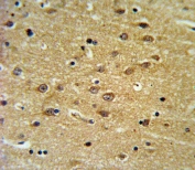 IHC testing of FFPE human brain tissue with EH domain-containing protein 3 antibody. HIER: steam section in pH6 citrate buffer for 20 min and allow to cool prior to staining.