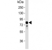 Western blot testing of human plasma lysate with Vitronectin antibody. Expected molecular weight: 54-75 kDa depending on glycosylation level.