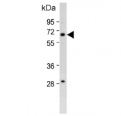 Western blot testing of human Caco-2 cell lysate with Vitronectin antibody. Expected molecular weight: 54-75 kDa depending on glycosylation level.