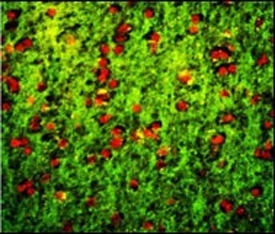 Immunofluorescent staining of FFPE human brain tissue with DPT antibody (green) and propidium iodide (red).