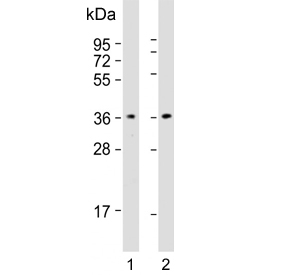 Western blot testing of human 1) A431 and 2) Jurkat cell lysate with CAPZA1 antibody. Predicted molecular weight ~33 kDa.