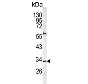 Western blot testing of human HL60 cell lysate with CAPZA1 antibody. Predicted molecular weight ~33 kDa.