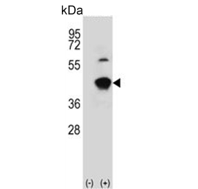 Western blot testing of 1) non-transfected and 2) transfected 293 cell lysate with GCAT antibody.