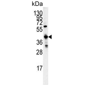 Western blot testing of mouse liver tissue lysate with GCAT antibody. Predicted molecular weight ~45 kDa.