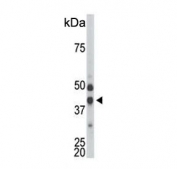 Western blot testing of mouse kidney tissue lysate with CDKL1 antibody. Predicted molecular weight ~42 kDa.