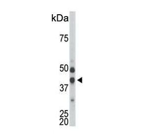 Western blot testing of mouse kidney tissue lysate with CDKL1 antibody. Predicted molecular weight ~42 kDa.