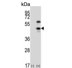 Western blot testing of 1) non-transfected and 2) transfected 293 cell lysate with CDKL1 antibody.