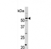 Western blot testing of mouse cerebellum tissue lysate with Cyclin-dependent kinase 14 antibody. Predicted molecular weight ~53 kDa.