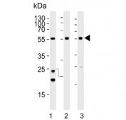 Western blot testing of 1) human HeLa, 2) human brain and 3) mouse cerebellum tissue lysate with Cyclin-dependent kinase 14 antibody. Predicted molecular weight ~53 kDa.