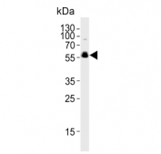 Western blot testing of human brain tissue lysate with Cyclin-dependent kinase 14 antibody. Predicted molecular weight ~53 kDa.