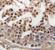 IHC testing of FFPE human testis tissue with Cyclin-dependent kinase 14 antibody. HIER: steam section in pH6 citrate buffer for 20 min and allow to cool prior to staining.