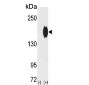 Western blot testing of 1) non-transfected and 2) transfected 293 cell lysate with ErbB2 antibody.