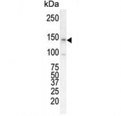 Western blot testing of human T-47D cell lysate with ErbB2 antibody. Expected molecular weight: 139-185 kDa depending on glycosylation level.