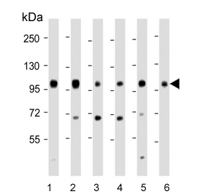 Western blot testing of 1) human 293T, 2) human A431, 3) mouse C2C12, 4) rat C6, 5) human HeLa and 6) mouse NIH 3T3 cell lysate with IGF1 Receptor antibody. Expected molecular weight: ~69 kDa (unglycosylated beta chain) up to ~200 kDa (glycosylated pro-form).