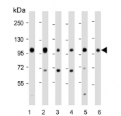 Western blot testing of 1) human 293T, 2) human A431, 3) mouse C2C12, 4) rat C6, 5) human HeLa and 6) mouse NIH 3T3 cell lysate with IGF1 Receptor antibody. Expected molecular weight: ~69 kDa (unglycosylated beta chain) up to ~200 kDa (glycosylated pro-form).