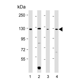 Western blot testing of human 1) HeLa, 2) K562, 3) T-47D and 4) mouse NIH 3T3 cell lysate with ROR2 antibody. Expected molecular weight: 105-130 kDa.