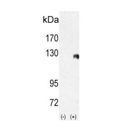 Western blot testing of 1) non-transfected and 2) transfected 293 cell lysate with ROR2 antibody.
